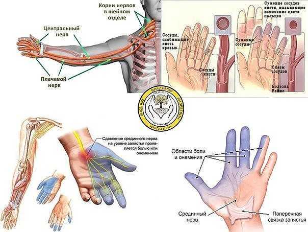 Причины онемения пальцев рук | eurolab | неврология