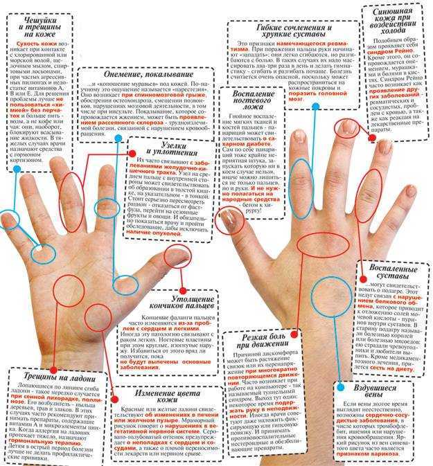 Болезнь нотта или стенозирующий лигаментит пальца: причины и лечение – эл клиника