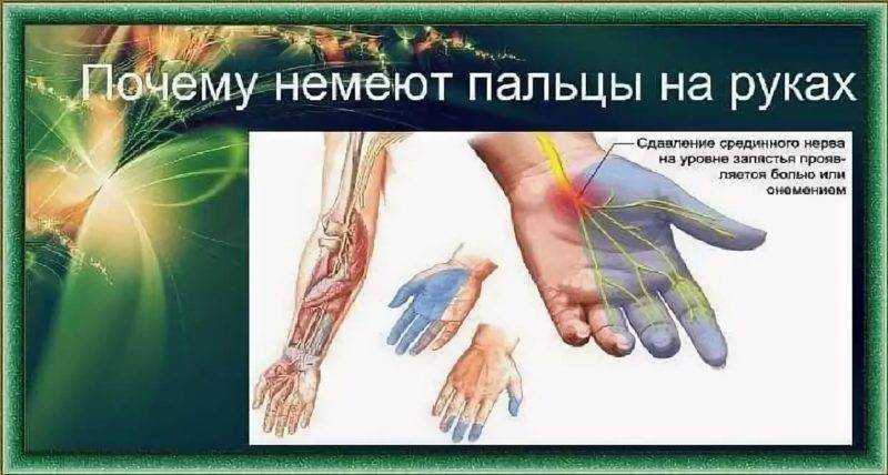 Болят кончики пальцев на руках | клиника "здравствуй!"