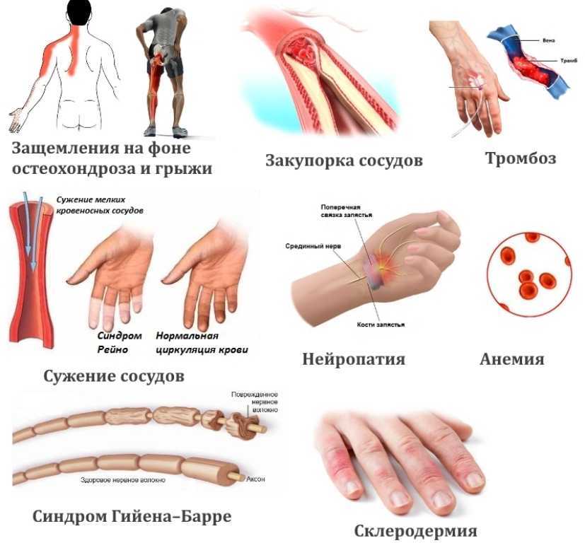 Немеют кончики пальцев рук и ног: причины и лечение